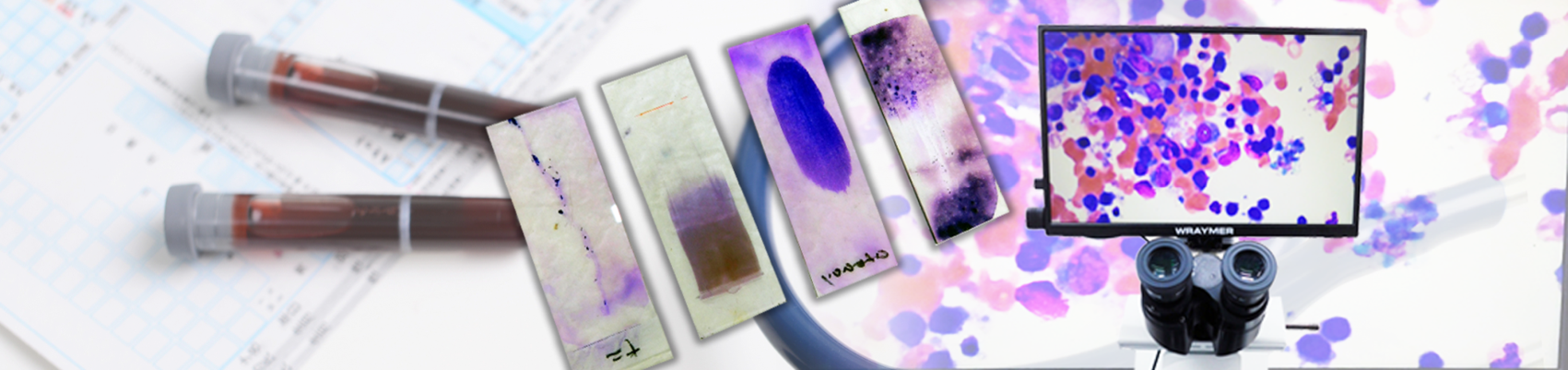 免疫・血液疾患外来