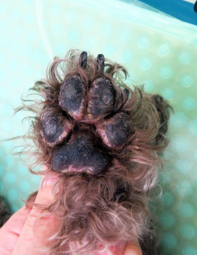 壊死性遊走性紅斑